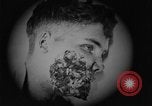 Image of injured soldier France, 1918, second 45 stock footage video 65675042433