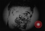 Image of injured soldier France, 1918, second 46 stock footage video 65675042433