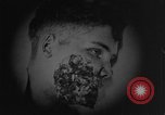 Image of injured soldier France, 1918, second 47 stock footage video 65675042433