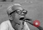 Immagine di Cambogiano di dentista Phnom Penh Cambogia, 1957, secondo 21 filmato di repertorio 65675043581