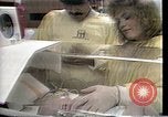 Image of organ transplants United States USA, 1986, second 28 stock footage video 65675044841