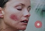 Image victime de viol United States USA, 1978, de la seconde 54 séquences d'archives historiques vidéo 65675045203