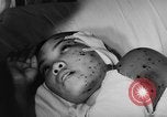 Image of wounded patients Vietnam, 1962, second 14 stock footage video 65675046660