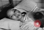 Image of wounded patients Vietnam, 1962, second 19 stock footage video 65675046660