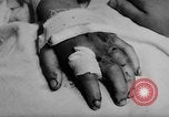 Image of wounded patients Vietnam, 1962, second 22 stock footage video 65675046660