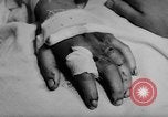 Image of wounded patients Vietnam, 1962, second 23 stock footage video 65675046660
