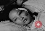 Image of wounded patients Vietnam, 1962, second 24 stock footage video 65675046660