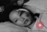 Image of wounded patients Vietnam, 1962, second 25 stock footage video 65675046660