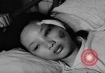 Image of wounded patients Vietnam, 1962, second 26 stock footage video 65675046660