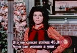 Image of uterine cancer United States USA, 1970, second 27 stock footage video 65675047044