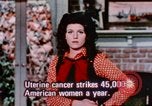 Image of uterine cancer United States USA, 1970, second 28 stock footage video 65675047044