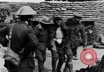 Image blessé des soldats britanniques entrez camp derrière les lignes France, 1916, de la seconde 22 séquences d'archives historiques vidéo 65675048387