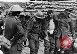 Image blessé des soldats britanniques entrez camp derrière les lignes France, 1916, de la seconde 23 séquences d'archives historiques vidéo 65675048387