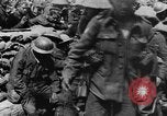 Image blessé des soldats britanniques traités à dressing station Minden France, 1916, de la seconde 18 séquences d'archives historiques vidéo 65675048388