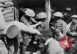 Image blessé des soldats britanniques traités à dressing station Minden France, 1916, de la seconde 47 séquences d'archives historiques vidéo 65675048388