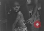 Image of Okinawa civilian wounded receive treatment  Okinawa Ryukyu Islands, 1945, second 32 stock footage video 65675051481