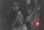Image of Okinawa civilian wounded receive treatment  Okinawa Ryukyu Islands, 1945, second 33 stock footage video 65675051481