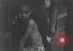Image of Okinawa civilian wounded receive treatment  Okinawa Ryukyu Islands, 1945, second 35 stock footage video 65675051481