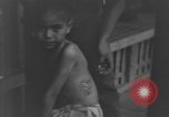 Image of Okinawa civilian wounded receive treatment  Okinawa Ryukyu Islands, 1945, second 36 stock footage video 65675051481