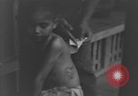 Image of Okinawa civilian wounded receive treatment  Okinawa Ryukyu Islands, 1945, second 37 stock footage video 65675051481