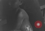 Image of Okinawa civilian wounded receive treatment  Okinawa Ryukyu Islands, 1945, second 43 stock footage video 65675051481