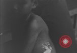 Image of Okinawa civilian wounded receive treatment  Okinawa Ryukyu Islands, 1945, second 46 stock footage video 65675051481