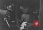 Image of Okinawa civilian wounded receive treatment  Okinawa Ryukyu Islands, 1945, second 54 stock footage video 65675051481