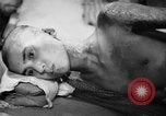 Image of Japanese patients Hiroshima Japan, 1945, second 44 stock footage video 65675052706