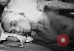 Image of Japanese patients Hiroshima Japan, 1945, second 45 stock footage video 65675052706