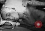 Image of Japanese patients Hiroshima Japan, 1945, second 48 stock footage video 65675052706