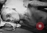 Image of Japanese patients Hiroshima Japan, 1945, second 49 stock footage video 65675052706
