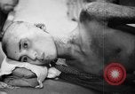 Image of Japanese patients Hiroshima Japan, 1945, second 50 stock footage video 65675052706