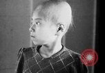 Standbild japanischen Patienten Hiroshima Japan, 1945, aus Sekunde 20 historischem Filmmaterial Videoclip 65675052708