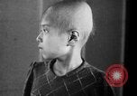 Standbild japanischen Patienten Hiroshima Japan, 1945, aus Sekunde 21 historischem Filmmaterial Videoclip 65675052708