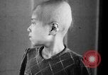 Standbild japanischen Patienten Hiroshima Japan, 1945, aus Sekunde 23 historischem Filmmaterial Videoclip 65675052708