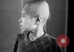 Standbild japanischen Patienten Hiroshima Japan, 1945, aus Sekunde 24 historischem Filmmaterial Videoclip 65675052708