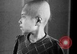 Standbild japanischen Patienten Hiroshima Japan, 1945, aus Sekunde 25 historischem Filmmaterial Videoclip 65675052708