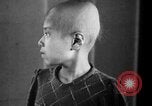 Standbild japanischen Patienten Hiroshima Japan, 1945, aus Sekunde 26 historischem Filmmaterial Videoclip 65675052708