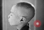 Standbild japanischen Patienten Hiroshima Japan, 1945, aus Sekunde 34 historischem Filmmaterial Videoclip 65675052708