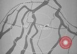 Image of microscopic view of skin Hiroshima Japan, 1945, second 6 stock footage video 65675052709