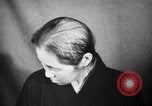 Image of microscopic view of skin Hiroshima Japan, 1945, second 14 stock footage video 65675052709