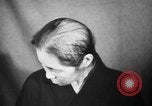Image of microscopic view of skin Hiroshima Japan, 1945, second 15 stock footage video 65675052709