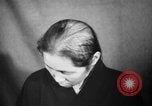 Image of microscopic view of skin Hiroshima Japan, 1945, second 16 stock footage video 65675052709