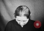 Image of microscopic view of skin Hiroshima Japan, 1945, second 17 stock footage video 65675052709