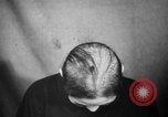Image of microscopic view of skin Hiroshima Japan, 1945, second 23 stock footage video 65675052709