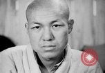 Image of microscopic view of skin Hiroshima Japan, 1945, second 32 stock footage video 65675052709