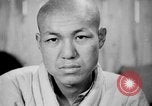 Image of microscopic view of skin Hiroshima Japan, 1945, second 33 stock footage video 65675052709