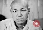 Image of microscopic view of skin Hiroshima Japan, 1945, second 34 stock footage video 65675052709