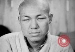 Image of microscopic view of skin Hiroshima Japan, 1945, second 35 stock footage video 65675052709