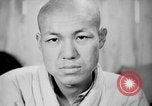 Image of microscopic view of skin Hiroshima Japan, 1945, second 36 stock footage video 65675052709